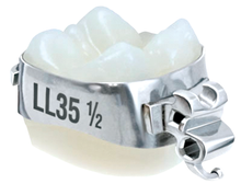 Load image into Gallery viewer, Supra™ Molar Band Kit