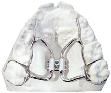 Load image into Gallery viewer, Philosophy 1™ Expander