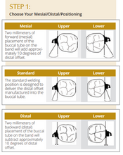 Load image into Gallery viewer, Supra™ Firm Molar Band pre-weld, with Double Lip Bumper, Gingival
