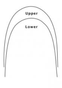 Stainless Steel Rectangular Archwires